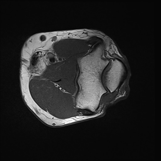 Click on the Serie image to view the images of Wieszt, Gnter